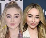 Sabrina Carpenter's Lip Injections: the Truth Revealed