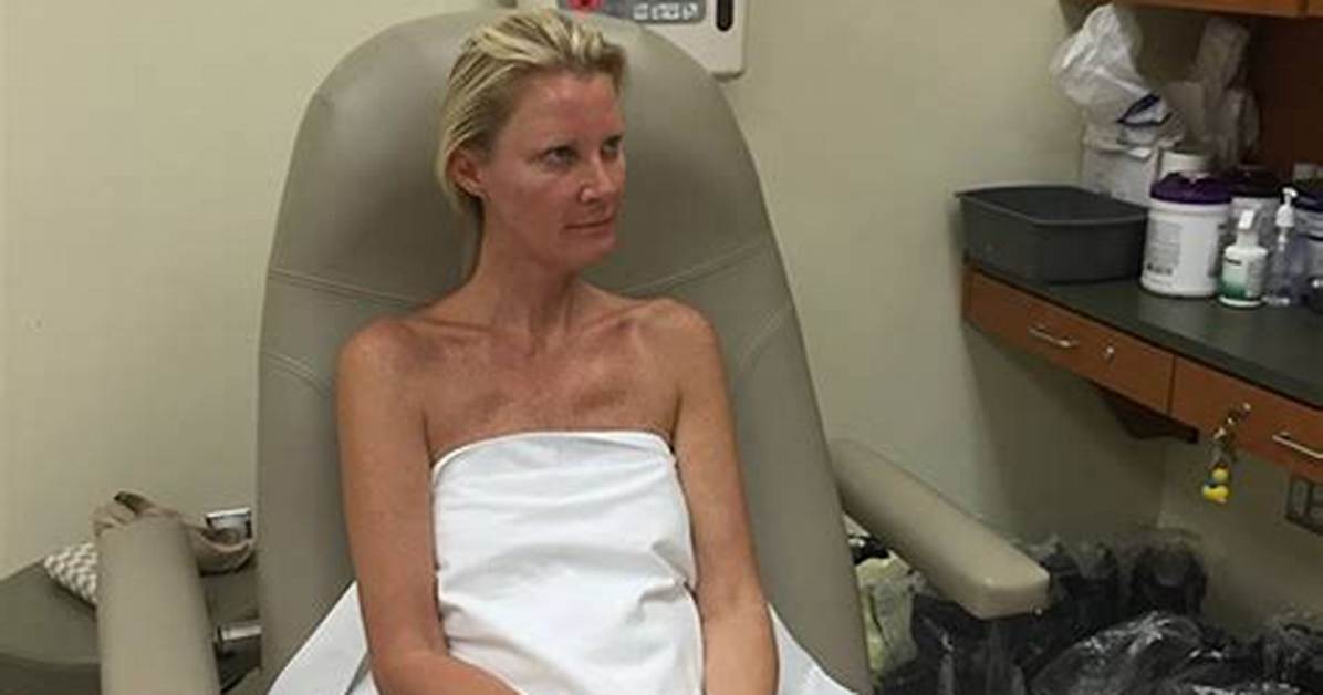 Sandra Lee Rushed to Hospital After Mastectomy Complications — Report
