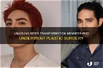 Sb19 Before and After Surgery: a Transformation Unraveled