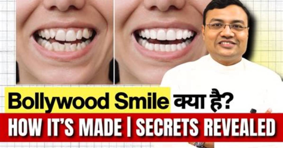 Secrets Before the Perfect Smile Revealed