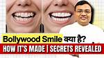 Secrets Before the Perfect Smile Revealed