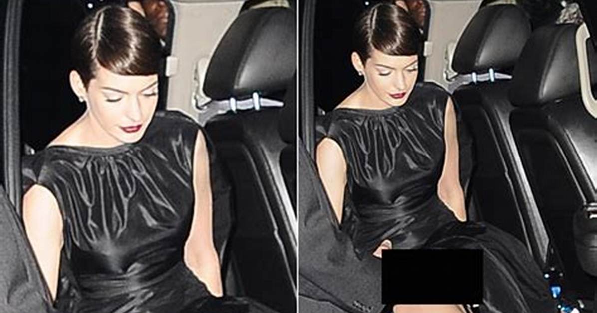 The Notorious Ann Hathaway Wardrobe Malfunction