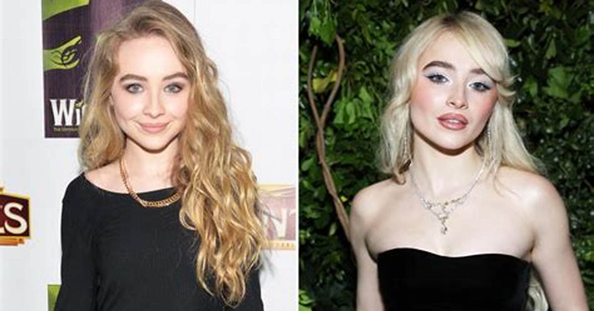 The Transformation of Sabrina Carpenter: Before and After Fillers Revealed