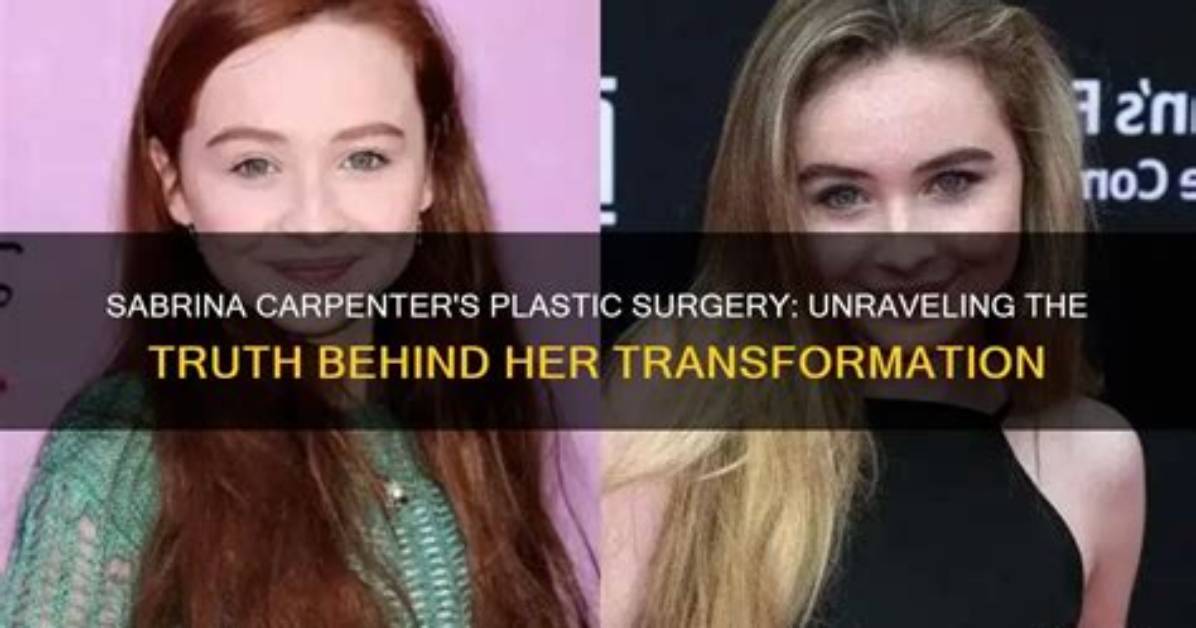 The Truth About Sabrina Carpenter's Plastic Surgery Speculations