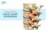 The Ultimate Guide to Facet Arthropathy: Definition, Symptoms, and Treatment
