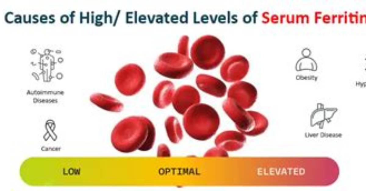 The Untold Significance of Elevated Ferritin Levels: Unlocking the Mystery