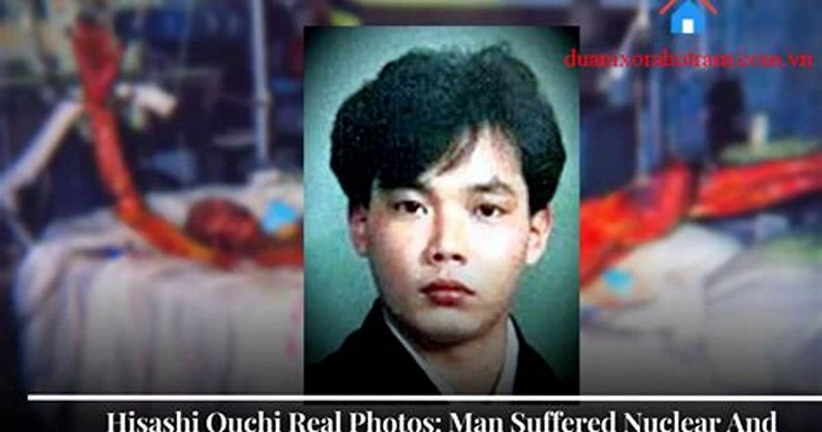 Unblurred Images Emerge: the Tragic Hisashi Ouchi Incident