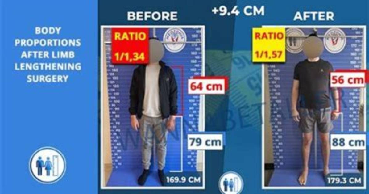 Uncover the Perfect Torso to Leg Ratio: a Guide to Proportion and Symmetry