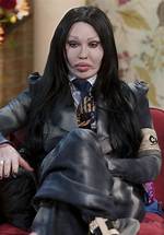 Understanding the Tragic Cause of Pete Burns' Untimely Demise