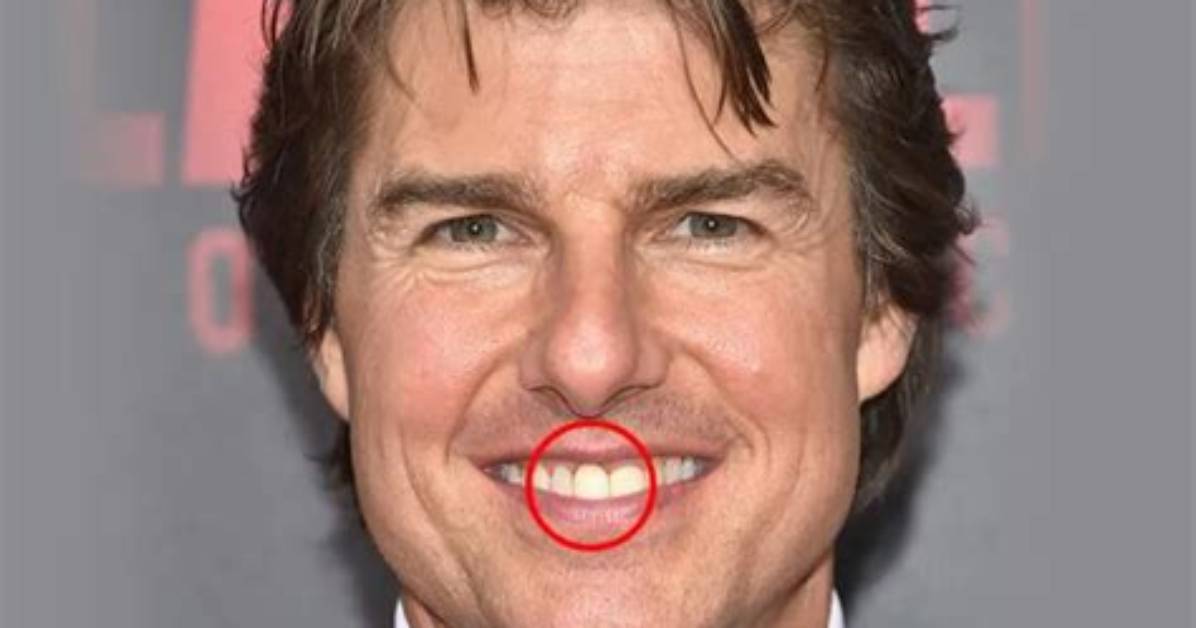 Unmasking Tom Cruise's Notorious Teeth: a Candid Examination