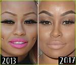 Unveil the Evolution of Blac Chyna: Before and After