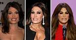 Unveiling Kimberly Guilfoyle's Botox Transformation: a Deep Dive into Cosmetic Enhancements