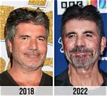 Unveiling the Transformation: Simon Cowell's Pre-Botox Era