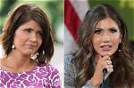 Unveiling the Truth: Kristi Noem's Plastic Surgery Journey