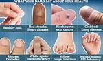 What You Should Know About Fingernails with Horizontal Ridges
