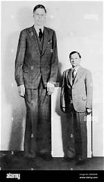 Will He Recover from Gigantism or Elephantitis? Health Update ·