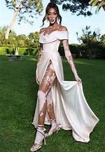 Winnie Harlow: a Model's Fortune Explored