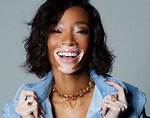 Winnie Harlow's Age: How Old Is the Canadian Model and Activist?