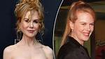 Woman, 54, Looks Like Nicole Kidman After Getting Surgery